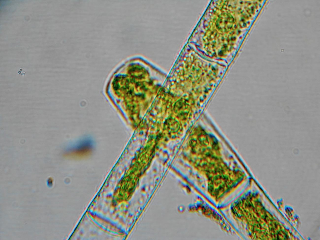 アオミドロの顕微鏡写真ミクロ観察3