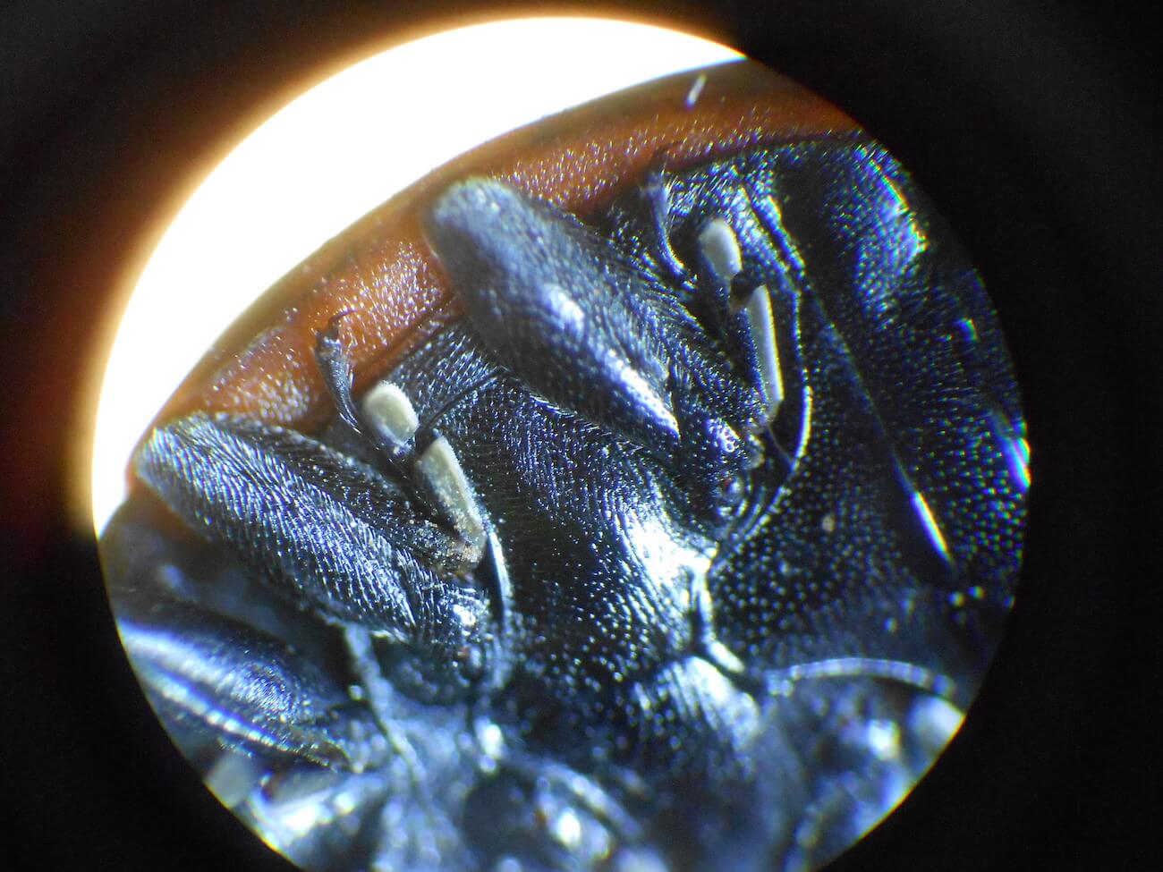 テントウムシの顕微鏡写真